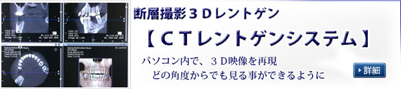 歯科CTレントゲン